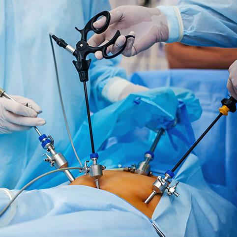 CIRUGÍA BARIÁTRICA