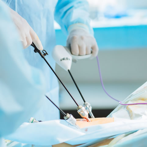 CIRUGÍA LAPAROSCÓPICA AVANZADA